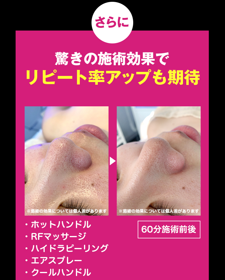 さらにリピート率アップも期待