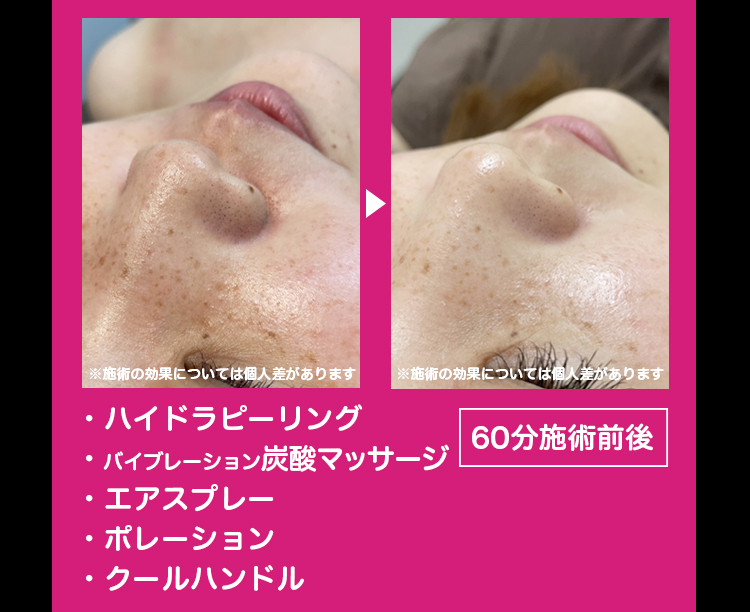 さらにリピート率アップも期待